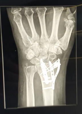 xray 1.jpg